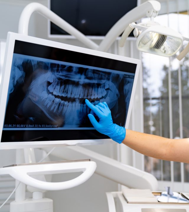 Teeth professional examining x ray. Dentistry radiography treatment.